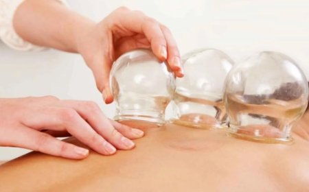 Hacamat ve Kupa Tedavisi: Bilim Ne Diyor, Modern Uygulama Nereye Gidiyor?