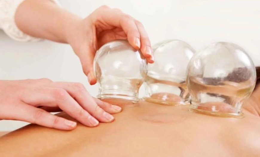 Hacamat ve Kupa Tedavisi: Bilim Ne Diyor, Modern Uygulama Nereye Gidiyor?